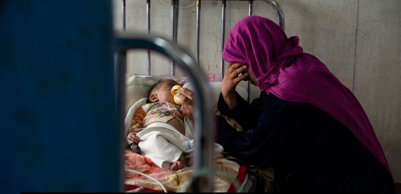 سازمان جهانی غذا: در هر ۱۰ ثانیه یک کودک در افغانستان دچار سوءتغذیه می‌شود